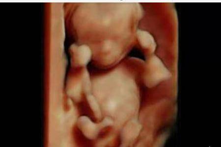 孕早期前两个月胎儿有多大 准妈妈肚子会有哪些症状