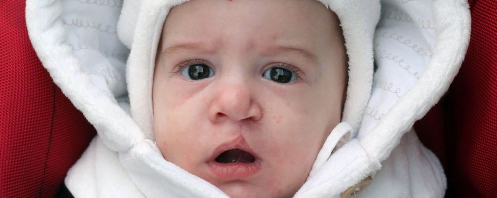 宝宝如何预防冬季感冒 有哪些食疗方法