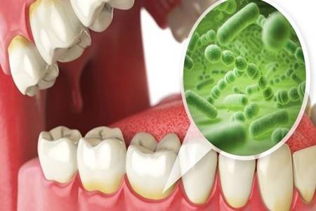 牙龈出血是什么原因?这三个原因都会导致牙龈出血肿痛