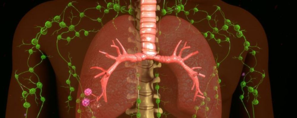 新冠肺炎和SARS的区别 肺部有什么不同