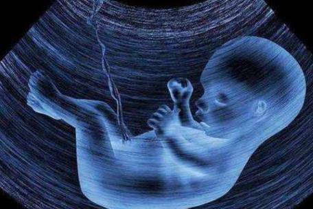 孕中期食谱大全 孕中期吃什么对胎儿智力发育好