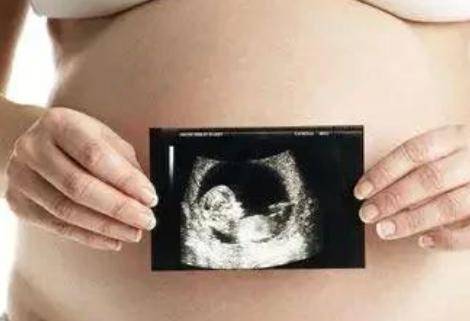 怀孕多久可以做b超 做B超憋尿的原因