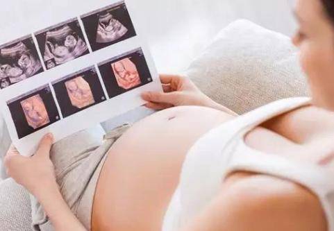 怀孕24周需要做什么检查什么?7项检查项目不能少