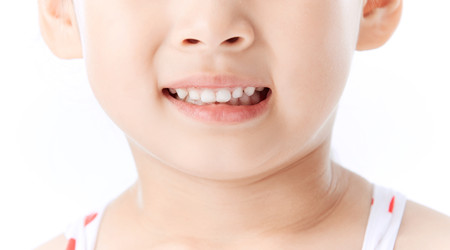 宝宝牙齿蛀牙应如何护理 蛀牙怎么办