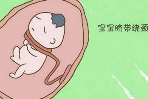 怀孕中期宝宝脐带绕颈总觉得喘,孕妈该怎么做?