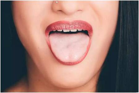 舌苔发黄是什么原因,六个不同症状判断病因对症下药