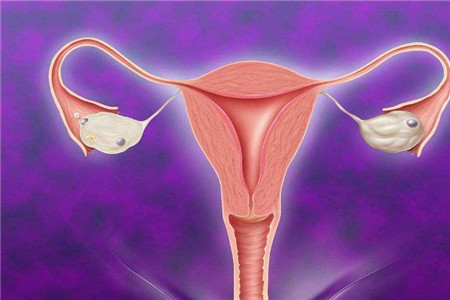 女人子宫最容易出现的四种疾病