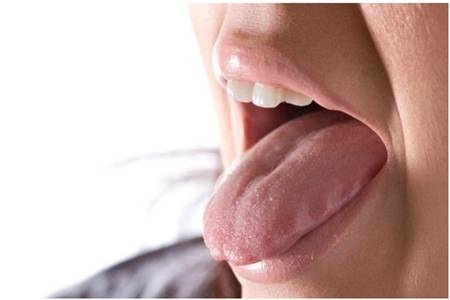 舌苔发黄是什么原因,黄腻舌苔小心这六种疾病