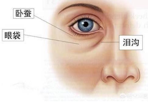 眼袋是怎么形成的 如何快速消除眼袋的三种方法
