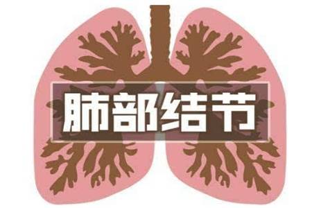 肺部结节是怎么形成的 肺部小结节如何治疗