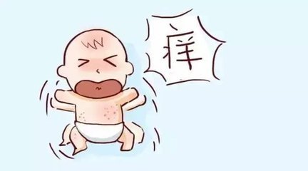 “宝宝干红痒,用屁屁香香” 宝宝常见皮肤问题护理
