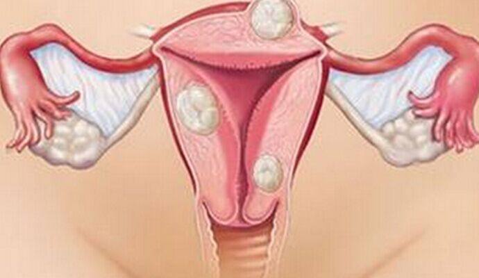 做输卵管造影到底痛不痛？哪些人适合做子宫输卵管造影检查呢？