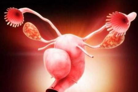 女人卵巢癌缠身的三个病因