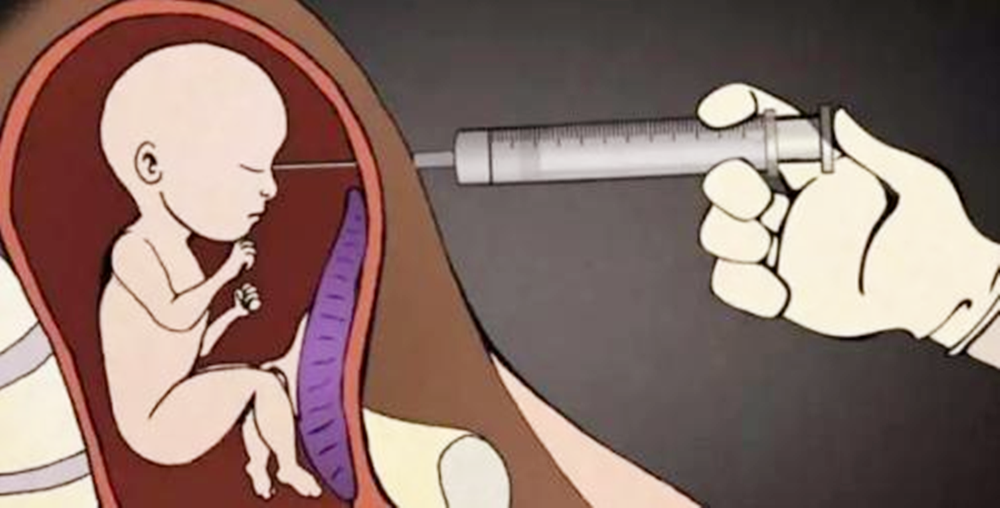母亲分享引产14周胎儿照片,小手小脚已成型,劝告女性流产要慎重