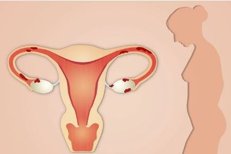 输卵管肿大是什么原因
