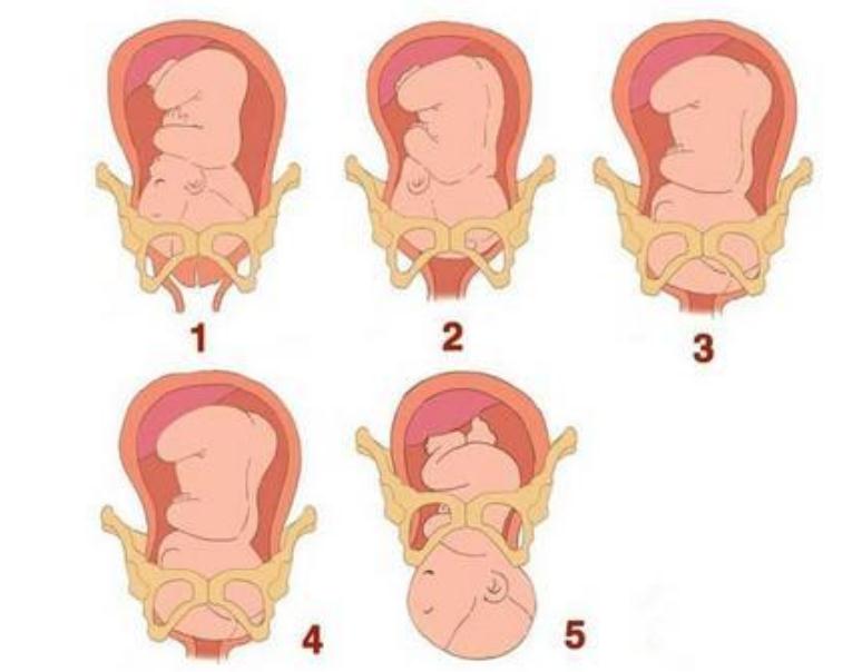 孕晚期有一种＂痛＂很难熬,4类孕妈更容易中招,比分娩更可怕