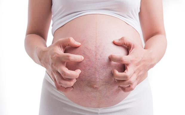 孕期里若没有出现这3种症状,那先恭喜了,说明胎宝宝发育很健康