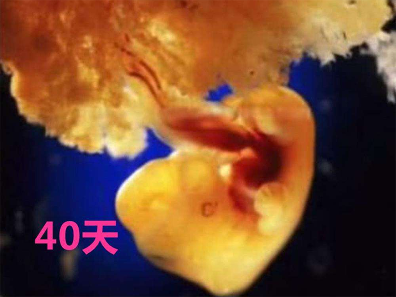 怀孕四十天孕囊有多大？需注意什么？