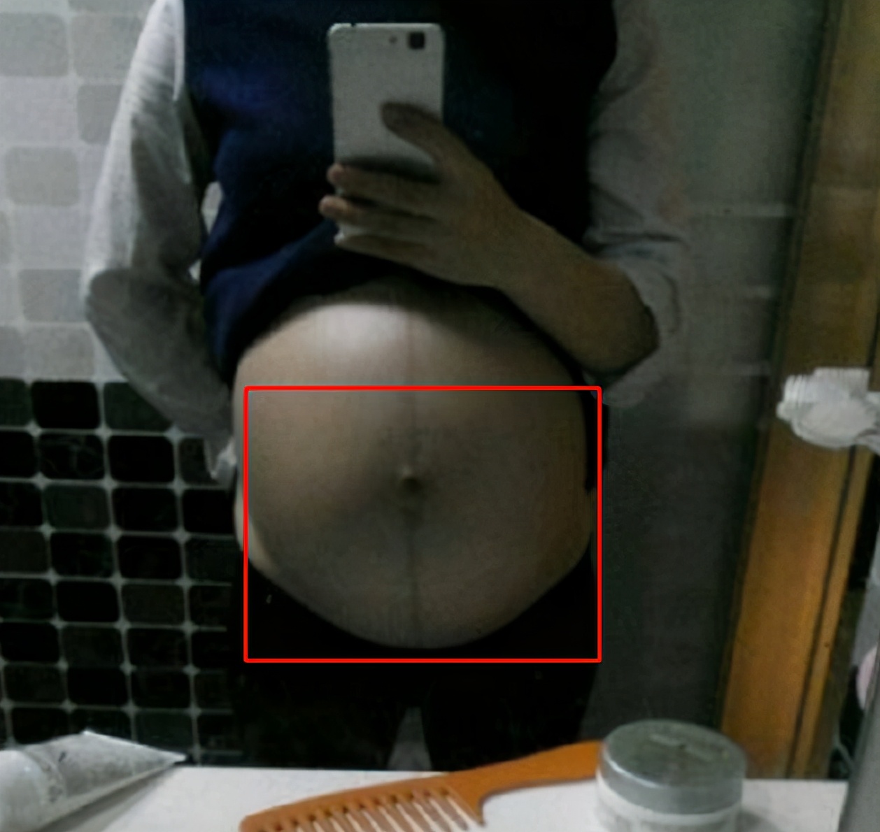 女性怀孕后,3部位会变＂黑＂,医生：别紧张,是胎儿发育良好
