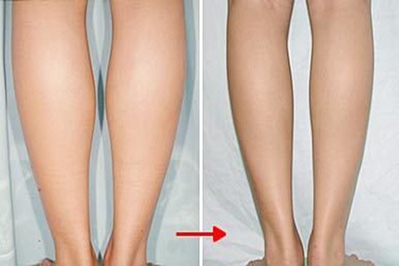 小腿怎么瘦下来？有效的瘦腿方法让粗腿变细腿