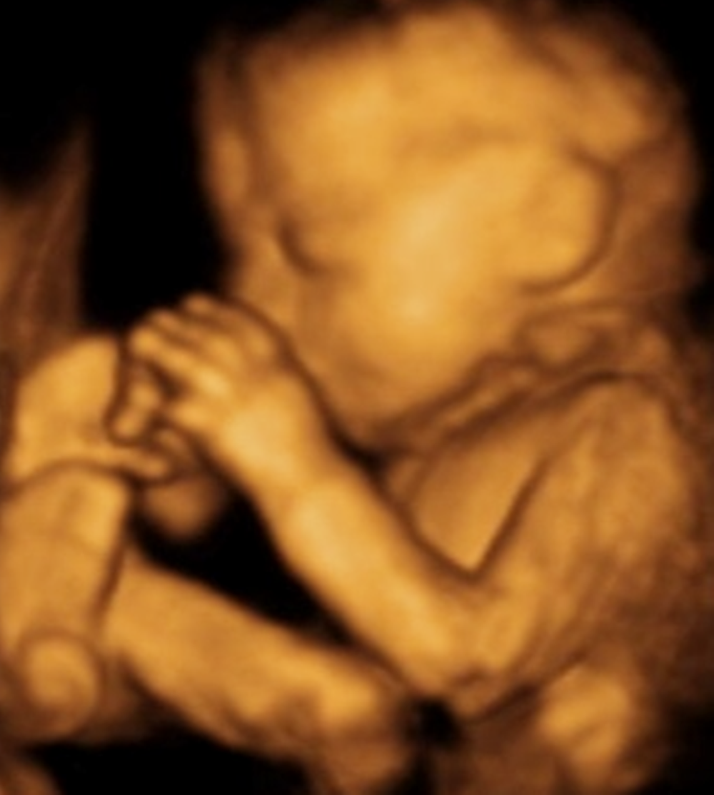 孕期做四维时,为何胎宝宝喜欢捂着脸呢？并非害羞,另有原因