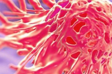 宫颈癌的常见表现以及治疗方法