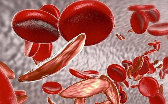 贫血是什么原因造成的 贫血吃什么效果好？