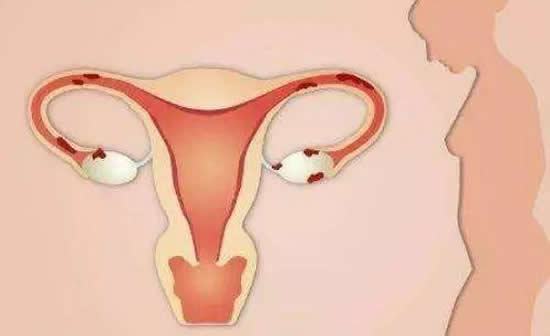正常子宫的大小是多少 子宫内膜厚度多少