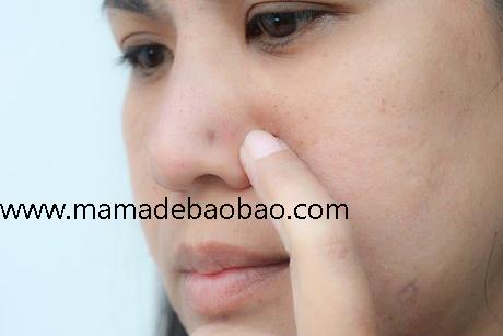 如何护理你的鼻洞: 9 步骤（穿鼻前的准备）