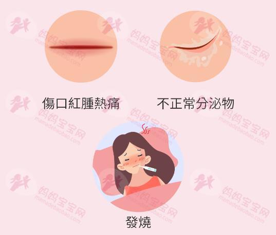 剖腹产伤口怎么顾才好的快?公开9个剖腹产伤口照护疑问