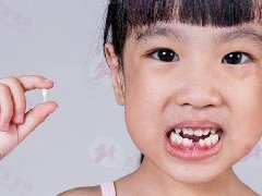 孩子成长的第二步——换牙期