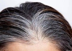 解密长白头发的四大原因：从遗传到精神因素，揭秘白发背后的秘密