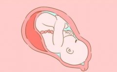 胎位不正的原因及处理方法详解