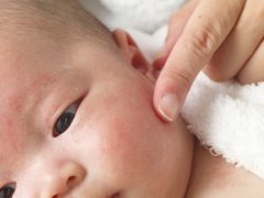 母乳过敏的儿童: 原因,迹象和解决方案