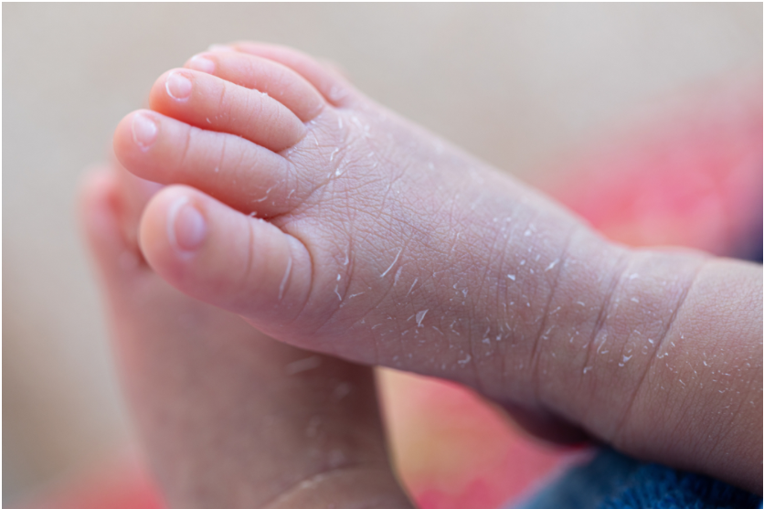 儿童脚底瘙痒危险吗?如何治愈孩子