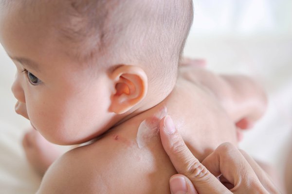 5种常见的新生儿疾病,妈妈越早发现越容易治愈