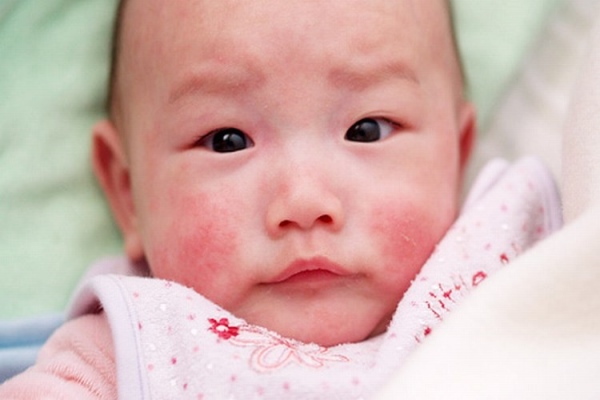 当婴儿被小米时,最有效的解决方案是什么?