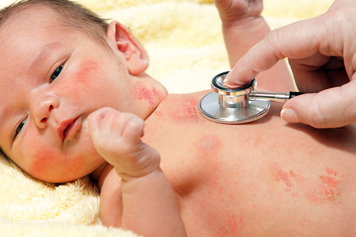 儿童神经带状疱疹,罕见但非常危险!