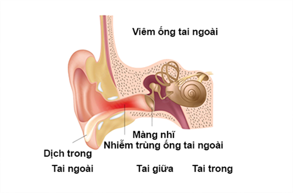 婴幼儿外耳道炎症状及治疗方法