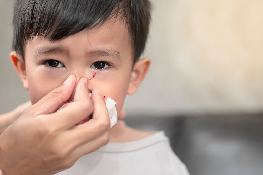 儿童流鼻血的治疗方法简单易用