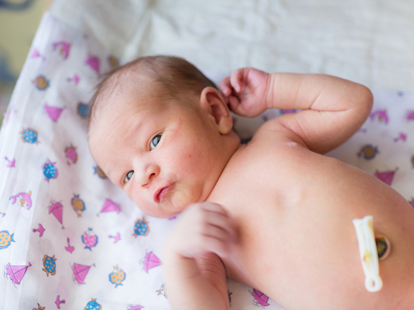 新生儿脐带脱落: 妈妈什么时候需要担心?