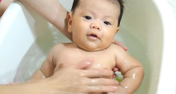 颈部有尿布疹的婴儿: 营救婴儿的5个步骤