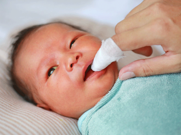 婴儿口腔真菌: 原因,体征和治疗
