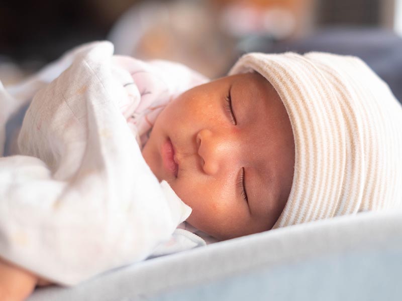 新生儿常见6大皮肤问题　有些会自行消失，有些需要就医