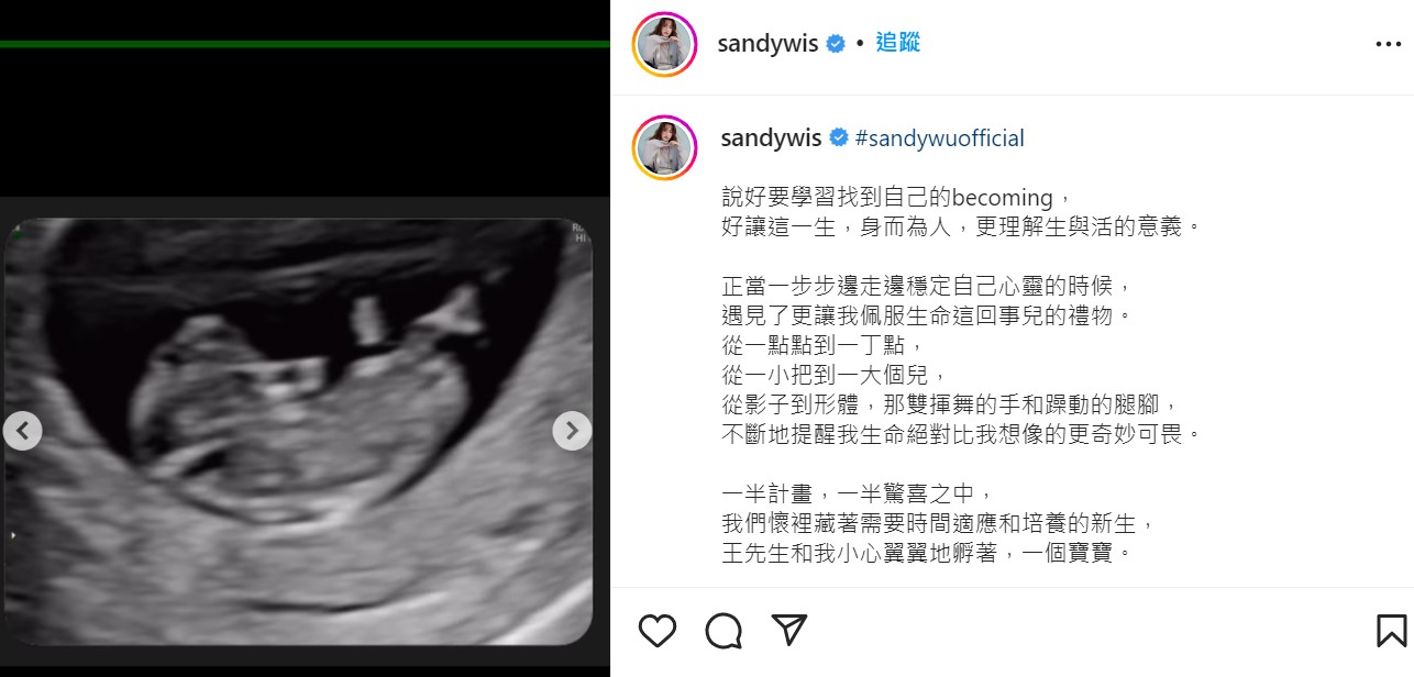 吴姗儒宣布怀孕五个月！阿公吴宗宪的6位数红包也准备好了！