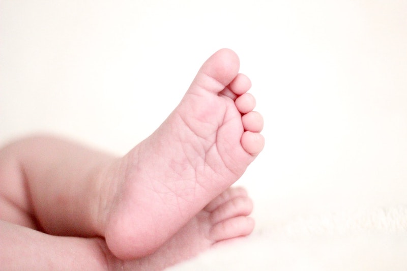 宝宝脚ㄚ变黄，难道是黄疸的问题？医生告诉你什么是「胡萝卜素血症」！