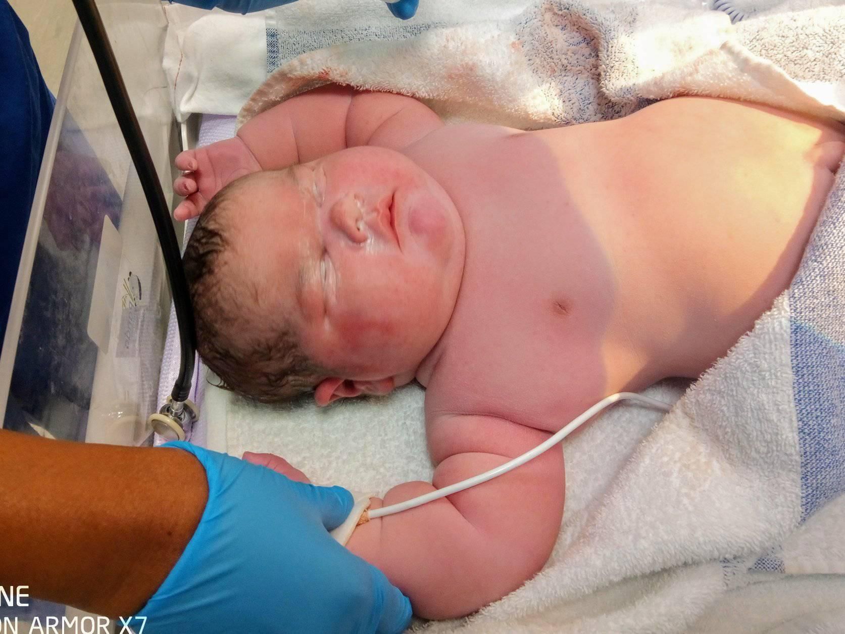 6.4kg巨婴出生「出动2护理师」英国史上第3重，医师：与妈妈饮食习惯有关！