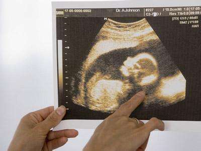 新一代香港验血技术可提前7天便知胎儿性别