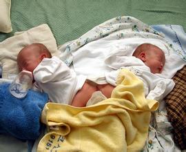 印度女子产双胞胎连体婴,孕期做好产检保证优生
