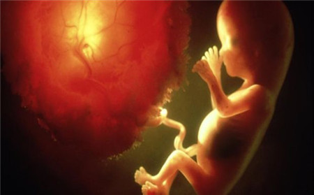 早孕胎停有什么症状 如何判断是否胎停育了